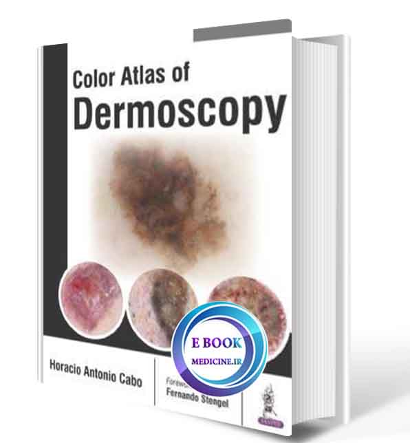 دانلود کتاب Color Atlas of Dermoscopy2017(Original PDF)